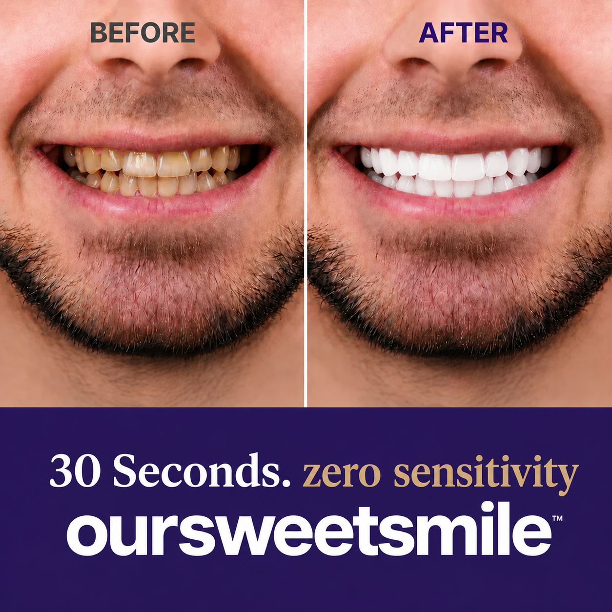 OurSweetSmile™ Purple Mouthwash - Sachets 20 Pack